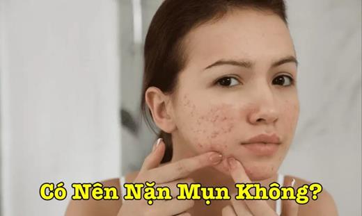 Có Nên Nặn Mụn Không