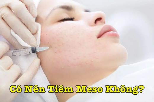 Có Nên Tiêm Meso Không?
