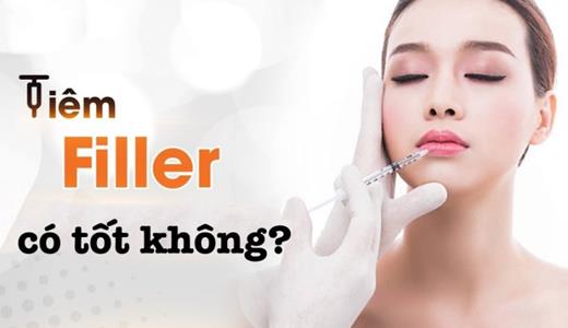 Tiêm filler có tốt không?