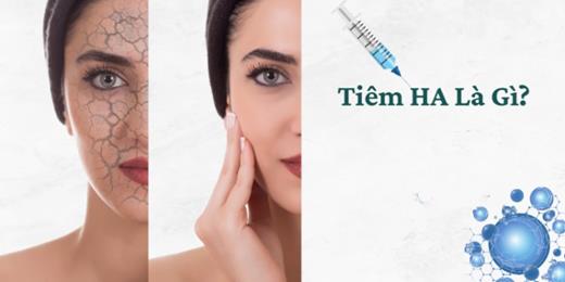Tiêm ha là gì? Lợi ích và tác hại của phương pháp tiêm HA