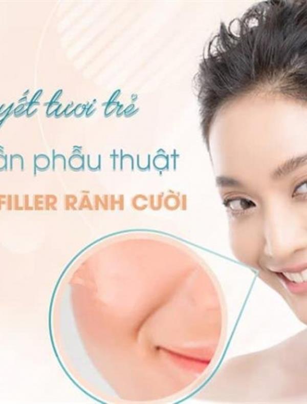 Tiêm Filler Rãnh Cười