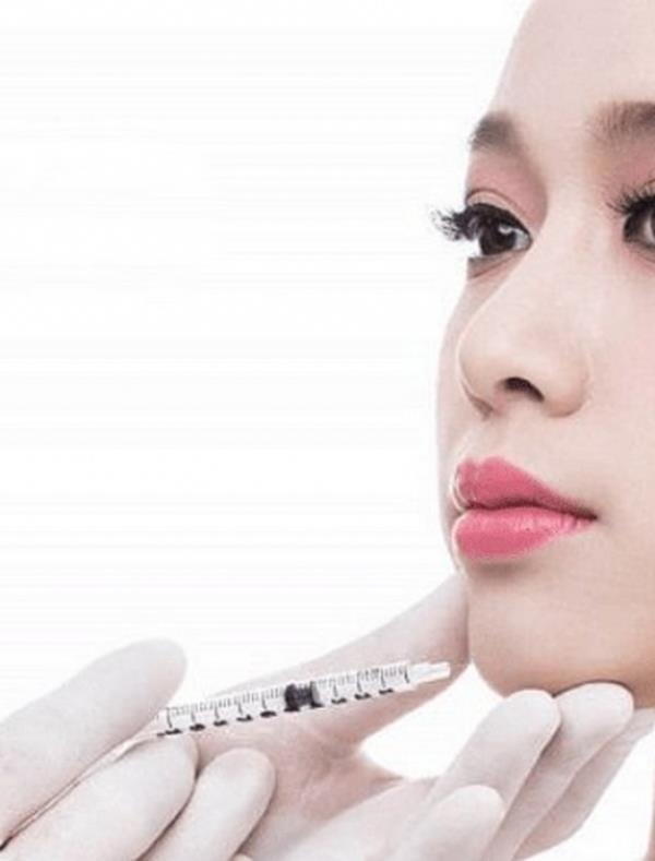 Tiêm Filler Cằm