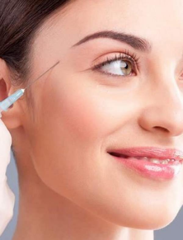 Tiêm Filler Thái Dương