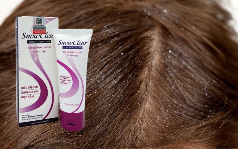 Thuốc trị nấm da đầu hiệu quả nhanh chóng