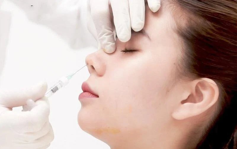 Tiêm filler chỉ an toàn khi thực hiện tại cơ sở y tế uy tín, với bác sĩ có kinh nghiệm và sử dụng chất làm đầy được nhập khẩu rõ ràng.