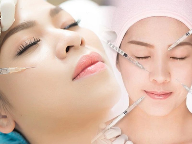 Tiêm filler nhiều lần không gây hại nhưng đôi khi sẽ gây tình trạng căng da, không đều màu.